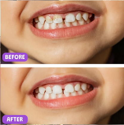 Vensonic™ Baby Electric Toothbrush (U-shaped)